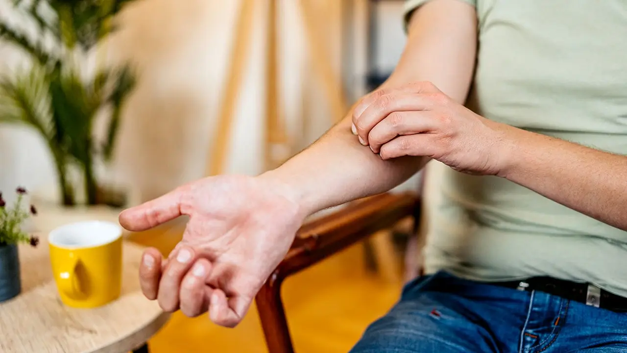 Study: Scratching Worsens Itch and Inflammation