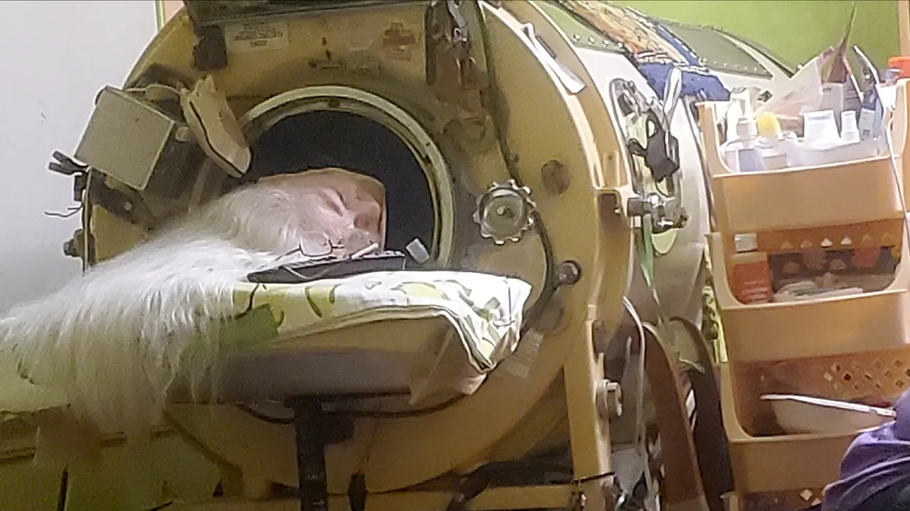 Last U.S. Iron Lung User Dies at 78