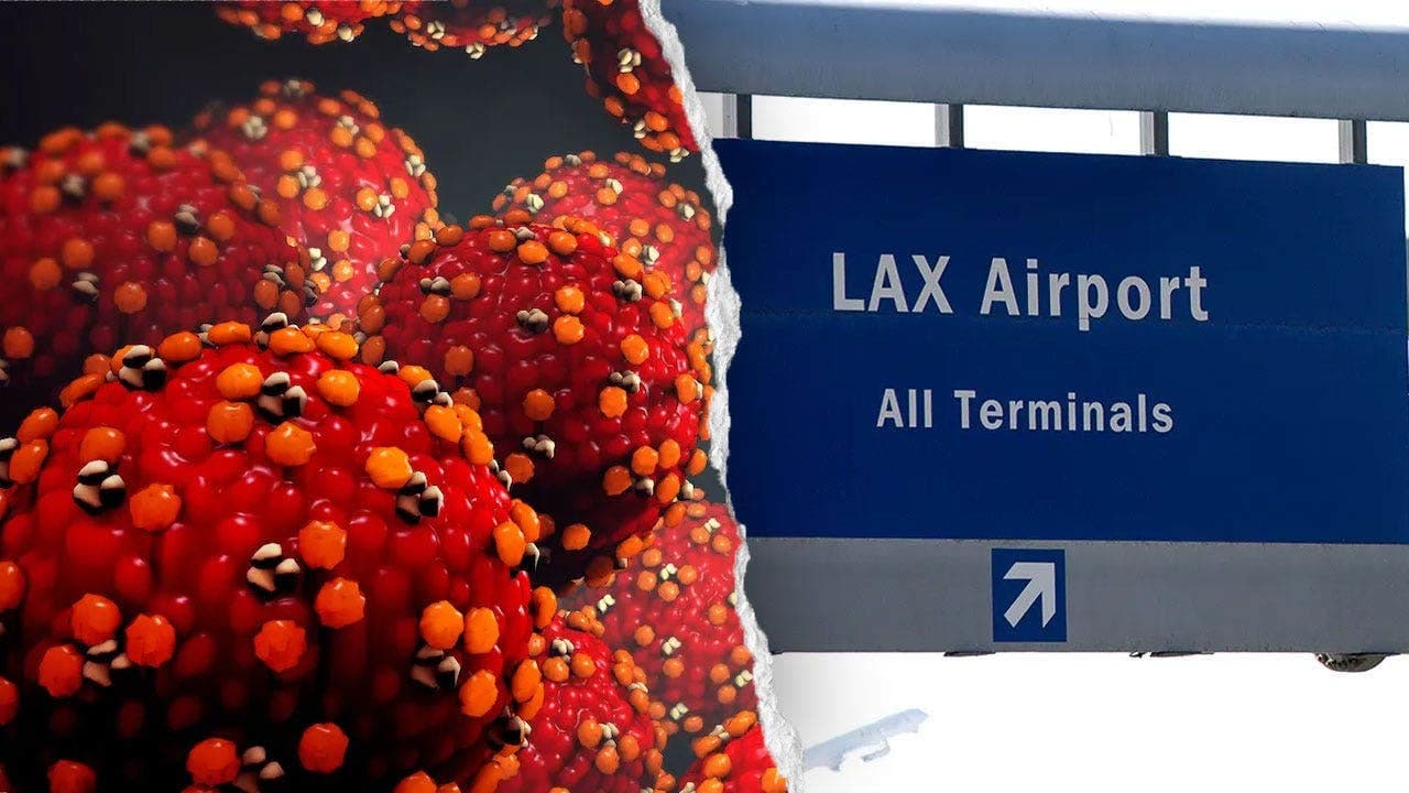 Measles Exposure Reported at LAX and Hotel